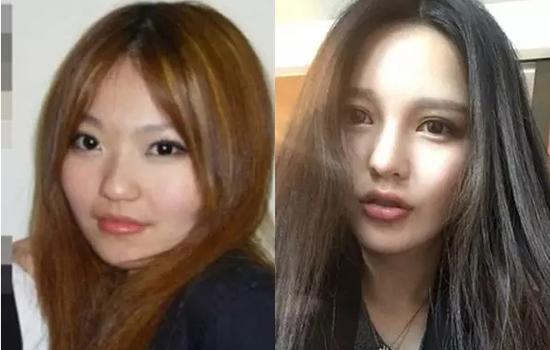 王思聪前女友张予曦整容前后对比图——