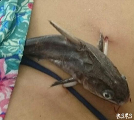 她在海边游泳腹部竟扎进一条鱼，看着都好疼！